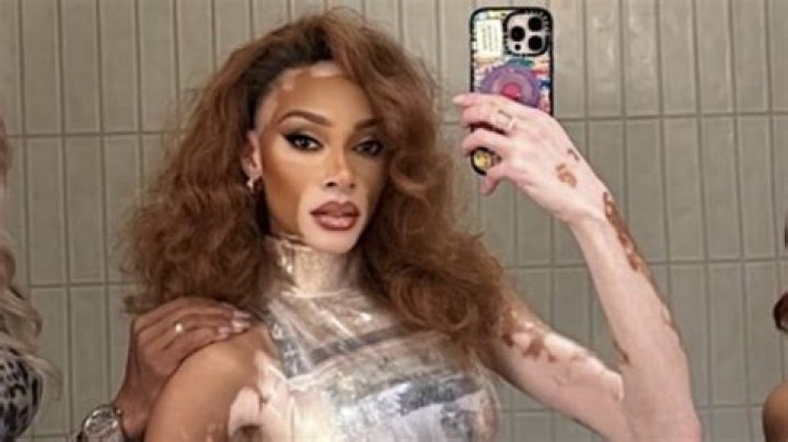 Controversy Surrounding The Popular Model